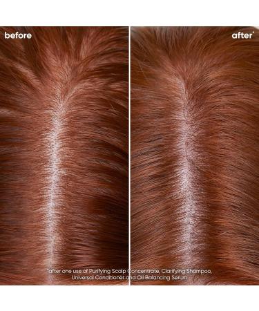 Biolage Scalp Sync Oil Balancing Serum - Lightweight Leave-In for Oily Scalp | Paraben & Silicone-Free | Vegan & Cruelty-Free - Reduce Excess Oil - Buy Online on SooperMarket.com