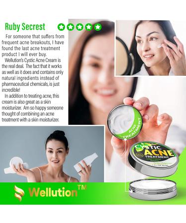 Cystic Acne Treatment & Scar Remover - USA Made Severe Acne Cleanser with Tea Tree Oil - Prevent Breakouts - Natural Pimple Cream - Buy Online on SooperMarket.com