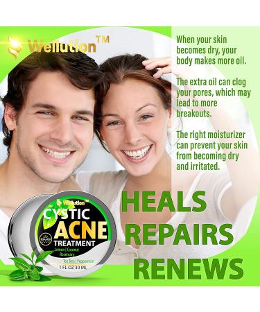 Cystic Acne Treatment & Scar Remover - USA Made Severe Acne Cleanser with Tea Tree Oil - Prevent Breakouts - Natural Pimple Cream - Buy Online on SooperMarket.com