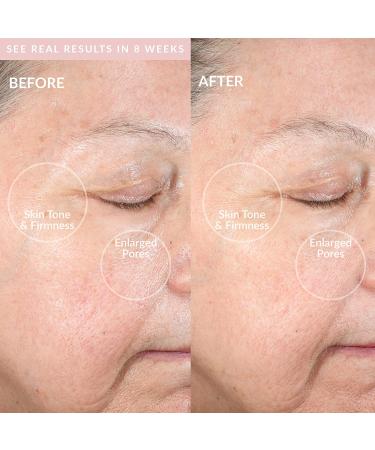 PMD Clean Pro: Smart Facial Cleansing Device & Anti-Aging Massager Blush - Buy Online on SooperMarket.com