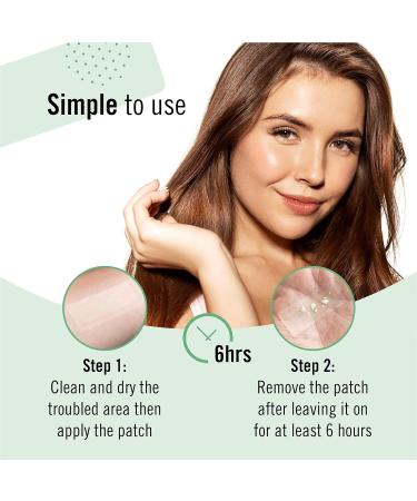 KASCIN Premium Spot Treatment Pimple Patch XL - 10 Hydrocolloid Acne Strips for Body, Larger Breakouts - Korean Made Acne Dots XL - Buy Online on SooperMarket.com