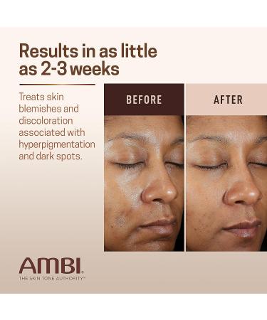 Ambi Even & Clear Fade Cream - Hyperpigmentation Treatment, Dark Spot Corrector with Niacinamide & Licorice Root Extract - 1 Fl Oz - Buy Online on SooperMarket.com