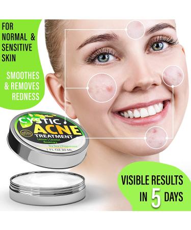 Cystic Acne Treatment & Scar Remover - USA Made Severe Acne Cleanser with Tea Tree Oil - Prevent Breakouts - Natural Pimple Cream - Buy Online on SooperMarket.com