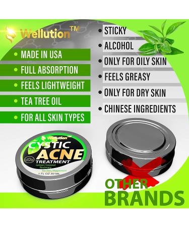 Cystic Acne Treatment & Scar Remover - USA Made Severe Acne Cleanser with Tea Tree Oil - Prevent Breakouts - Natural Pimple Cream - Buy Online on SooperMarket.com