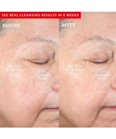PMD Clean Redvolution - Smart Facial Cleansing Device with Silicone Brush & Red Light Therapy for Smoother Skin Fine Lines Reduction & Firming - Face & Body Care - Buy Online on SooperMarket.com