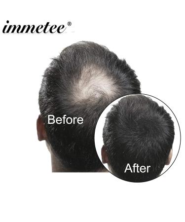 IMMETEE Hair Building Fibers - Instant Regrowth for Thinning Hair & Bald Spots - 28g Black - Conceals Hair Loss in 15 Seconds - For Men & Women - Buy Online on SooperMarket.com
