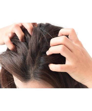 Difeel Peppermint Hot Oil Treatment for Dry Scalp - 7.1 oz | Soothes Irritation & Flakes - Buy Internationally - Buy Online on SooperMarket.com