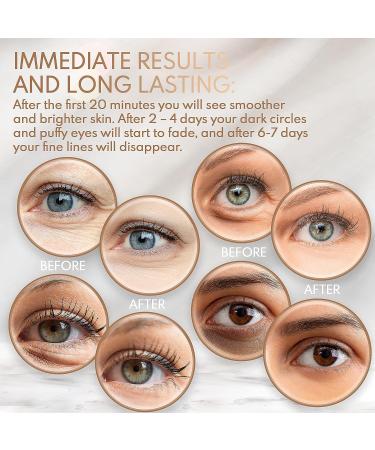 Under Eye Collagen Mask for Anti-Aging, Wrinkles, Puffy Eyes, Dark Circles - 12 Pairs - Buy Online on SooperMarket.com