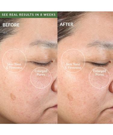 Shop PMD Personal Microderm Clean Smart Facial Cleansing Device - Olive | International Shipping Available - Buy Online on SooperMarket.com