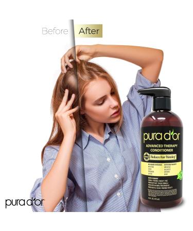PURA D'OR Advanced Therapy Conditioner with Argan Oil & Biotin - 16 fl oz - For Men & Women - Sulfate-Free - Buy Online on SooperMarket.com