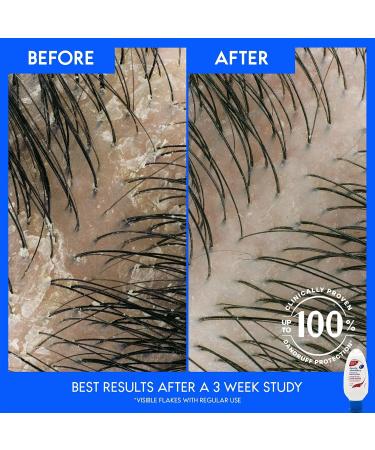 Head and Shoulders Smooth and Silky Conditioner - Fights Dandruff Smooths Frizzy Hair 1.7 oz (Pack of 6) - International Shipping Available - Buy Online on SooperMarket.com