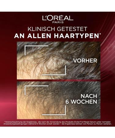 L'Or al Paris Elvital Serum | Anti-Hair Loss Treatment for Weak & Brittle Hair | 1.5% Aminexil Caffeine Arginine | 3 Pack (102 ml) - Buy Online on SooperMarket.com