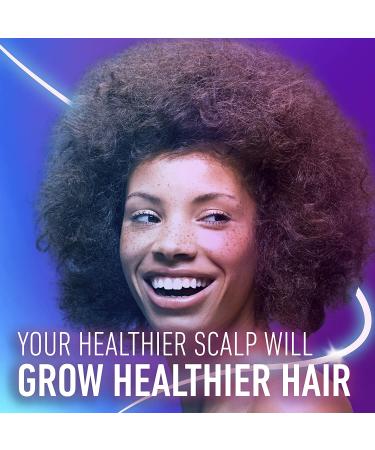 Aussie Top Down Scalp Tonic with Pepperberry & Tea Tree Oil - 4 Fl Oz - Buy Online on SooperMarket.com