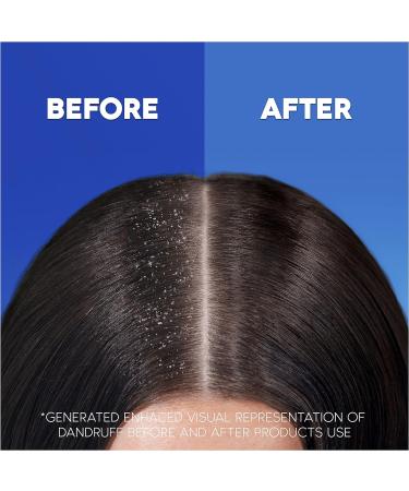 Head & Shoulders Apple Fresh Anti Dandruff Shampoo 1000ml - 100% Flake Free & Clinically Proven - Daily Use for Clean Feeling Hair and Scalp - XXL Size - Buy Online on SooperMarket.com