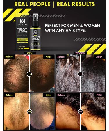 MR ALPHA Biotin Hair & Beard Growth Booster Serum for Men and Women - Buy Online on SooperMarket.com
