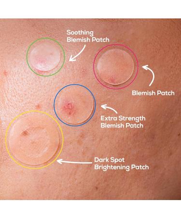 HANHOO Blemish Patch Discovery Kit | 7-Piece Hydrocolloid Variety Set for Pimples Dark Spots & Clogged Pores | International Shipping Available - Buy Online on SooperMarket.com