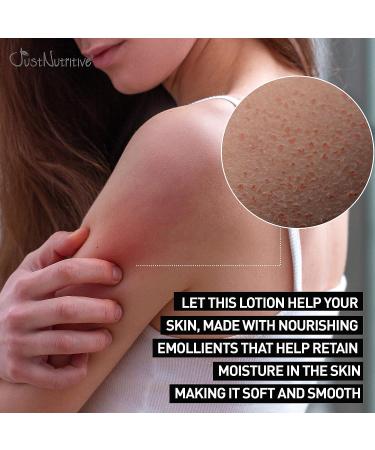Just Nutritive Rough and Bumpy Skin Lotion - Smoothing Body Lotion for Dry, Rough Patches, Keratosis Pilaris - 8 Oz - Buy Online on SooperMarket.com