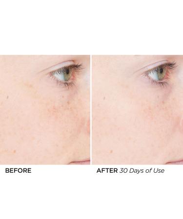 Shop BeautyBio The Nightly Overnight Retinol Repair + Peptide Anti-Aging Serum - 1 oz/ 30 mL Online - Best Price & International Shipping - Buy Online on SooperMarket.com