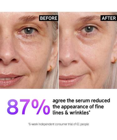 Shop The INKEY List Retinol Fine Lines and Wrinkles Serum - 1 oz/ 30 mL Online - Best Price & International Shipping - Buy Online on SooperMarket.com
