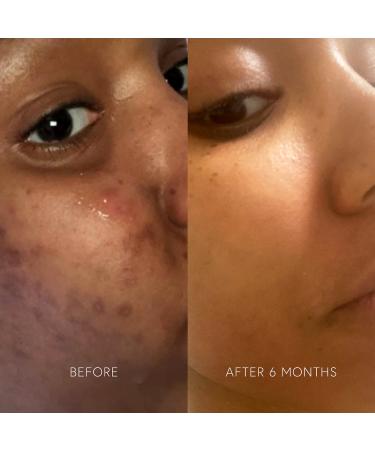 Shop Dr. Barbara Sturm Clarifying Mask - 1.69 oz/ 50 mL Online - Best Price & International Shipping - Buy Online on SooperMarket.com