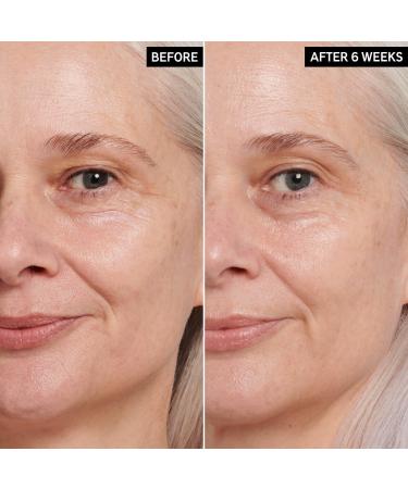 Shop The INKEY List Retinol Eye Cream - 0.5 oz/ 15 mL Online - Best Price & International Shipping - Buy Online on SooperMarket.com