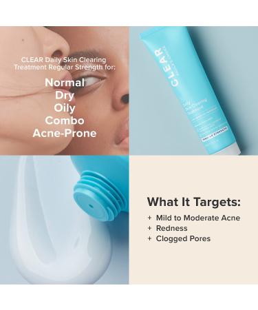 Shop Paula's Choice CLEAR Daily Skin Clearing Treatment with 2.5% Benzoyl Peroxide - 2.25 oz/ 67 mL Online - Best Price & International Shipping - Buy Online on SooperMarket.com