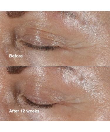 Shop CLINIQUE Smart Clinical Repair Wrinkle Correcting Eye Cream - 0.5 oz/ 15 mL Online - Best Price & International Shipping - Buy Online on SooperMarket.com