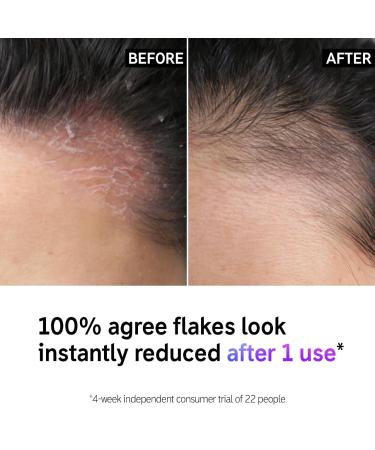 Shop The INKEY List Salicylic Acid Oily Scalp Treatment						 - 5 oz/ 150 mL Online - Best Price & International Shipping - Buy Online on SooperMarket.com