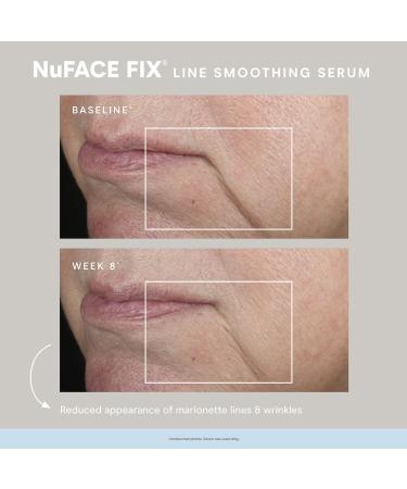 Shop NuFACE FIX Line Smoothing Serum - 0.5 oz/ 15 mL Online - Best Price & International Shipping - Buy Online on SooperMarket.com