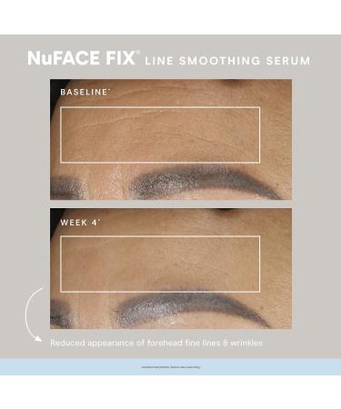 Shop NuFACE FIX Line Smoothing Device Online - Best Price & International Shipping - Buy Online on SooperMarket.com