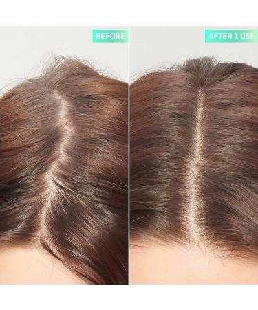 Shop The INKEY List Glycolic Acid Exfoliating Scalp Scrub - 5 oz / 150 mL Online - Best Price & International Shipping - Buy Online on SooperMarket.com