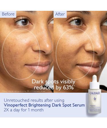 Shop Caudalie Vinoperfect Brightening Dark Spot Serum Vitamin C Alternative - 1 oz / 30 ml Online - Best Price & International Shipping - Buy Online on SooperMarket.com