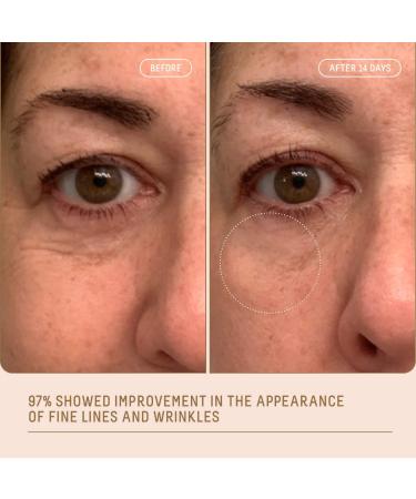Shop Biossance Squalane + Marine Algae Eye Cream for Fine Lines & Dark Circles - 0.5 oz / 15 mL Online - Best Price & International Shipping - Buy Online on SooperMarket.com