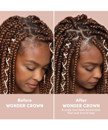 Shop Mizani Wonder Crown Clarifying Scalp Treatment - 6.8 oz/ 200mL Online - Best Price & International Shipping - Buy Online on SooperMarket.com