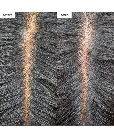 Shop Briogeo Scalp Revival Charcoal + Tea Tree Cooling Hydration Mask for Dry Itchy Scalp - 6 oz/ 177 mL Online - Best Price & International Shipping - Buy Online on SooperMarket.com