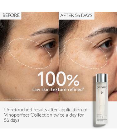 Shop Caudalie Vinoperfect Brightening Glycolic Essence - 5.0 oz/ 150 mL Online - Best Price & International Shipping - Buy Online on SooperMarket.com