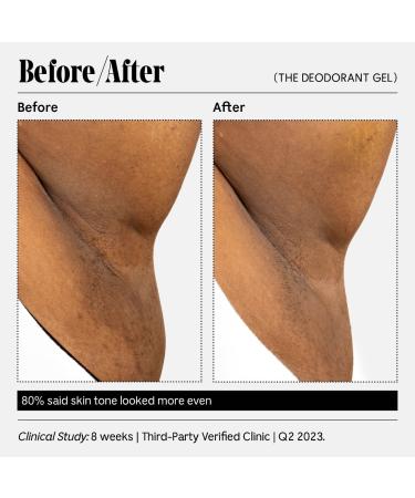Shop N cessaire The Deodorant Gel - With 5% Alpha Hydroxy Acid (AHA) and Niacinamide - 1.7 oz/ 50 ml Eucalyptus Online - Best Price & International Shipping - Buy Online on SooperMarket.com
