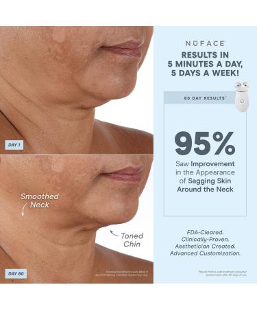 Shop NuFACE Trinity + Wrinkle Reducer Attachment Online - Best Price & International Shipping - Buy Online on SooperMarket.com