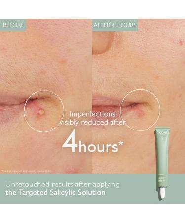 Shop Caudalie Vinopure Color Correcting Spot Solution with Salicylic Acid - .5 oz / 15 ml Online - Best Price & International Shipping - Buy Online on SooperMarket.com