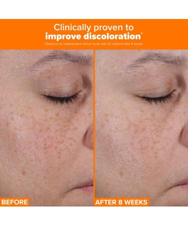 Shop Paula's Choice 25% Vitamin C + Glutathione Clinical Serum for Brightening and Discoloration	 - 1 oz / 30 ml Online - Best Price & International Shipping - Buy Online on SooperMarket.com
