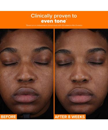 Shop Paula's Choice 25% Vitamin C + Glutathione Clinical Serum for Brightening and Discoloration	 - 1 oz / 30 ml Online - Best Price & International Shipping - Buy Online on SooperMarket.com