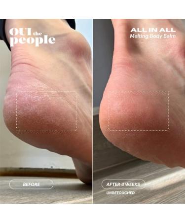 Shop OUI the People All In All Melting Body Balm with Plant-Based Retinol - 3.4 oz / 100 ml Online - Best Price & International Shipping - Buy Online on SooperMarket.com