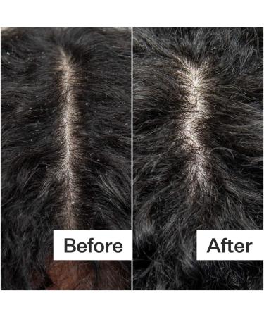 Shop Act+Acre Cold Processed Scalp Detox Oil For Dry Scalp - 3 oz / 89 ml Online - Best Price & International Shipping - Buy Online on SooperMarket.com