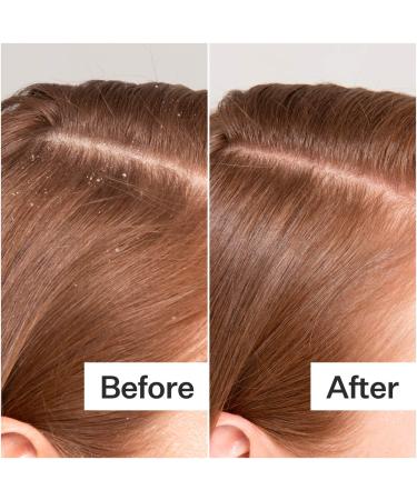 Shop Act+Acre Cold Processed Scalp Detox Oil For Dry Scalp - 3 oz / 89 ml Online - Best Price & International Shipping - Buy Online on SooperMarket.com