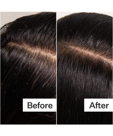 Shop Act+Acre Cold Processed Scalp Detox Oil For Dry Scalp - 3 oz / 89 ml Online - Best Price & International Shipping - Buy Online on SooperMarket.com