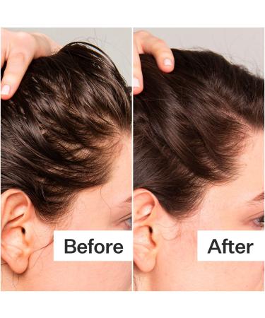 Shop Act+Acre Salicylic Acid Scalp Renew Exfoliator For Oily + Flakey Scalp - 2 oz / 60 ml Online - Best Price & International Shipping - Buy Online on SooperMarket.com