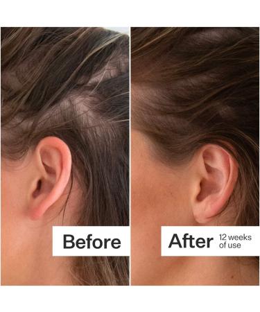 Shop Act+Acre Thick + Full Hair Capsules for Fuller-Looking Hair - 5.3 oz / 150 g Online - Best Price & International Shipping - Buy Online on SooperMarket.com