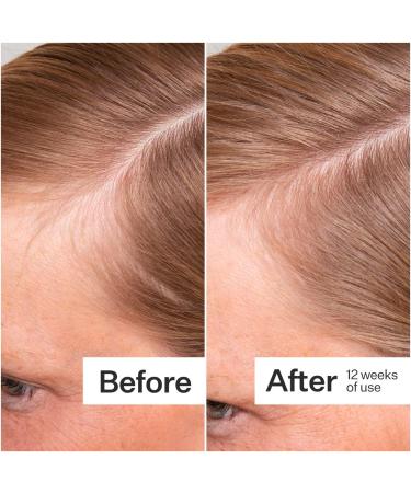 Shop Act+Acre Thick + Full Hair Capsules for Fuller-Looking Hair - 5.3 oz / 150 g Online - Best Price & International Shipping - Buy Online on SooperMarket.com