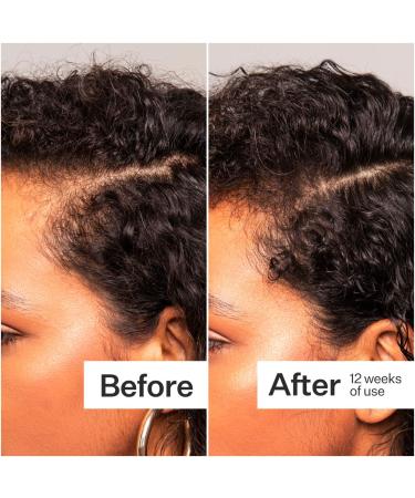 Shop Act+Acre Thick + Full Hair Capsules for Fuller-Looking Hair - 5.3 oz / 150 g Online - Best Price & International Shipping - Buy Online on SooperMarket.com