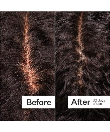 Shop Act+Acre Microbiome Cooling Scalp Serum For Dry Itchy Scalp + Loose Flakes - 2.2 oz Online - Best Price & International Shipping - Buy Online on SooperMarket.com